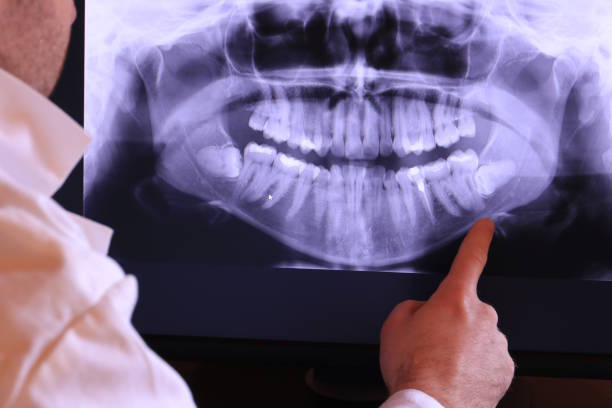 Best Weekend Emergency Dentist in Au Sable, MI