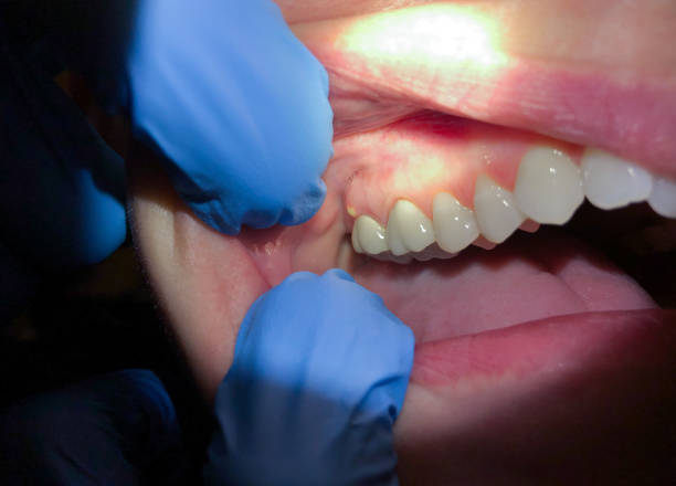 Best After-Hours Emergency Dentist in Au Sable, MI